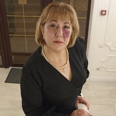 Флора, 50, Голая Пристань